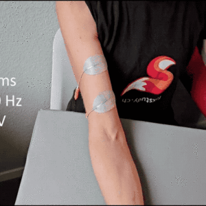 Moderne Elektrostimulation verstehen und anwenden